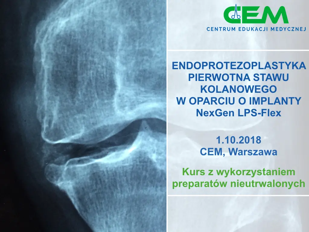 CMC_Endoprotezoplastyka_kurs_CEM CEM zaprasza na kurs wszystkich ortopedów!