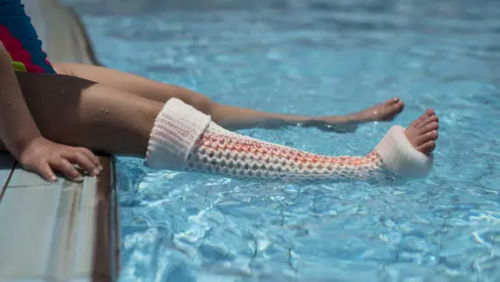 Waterproof and lightweight cast