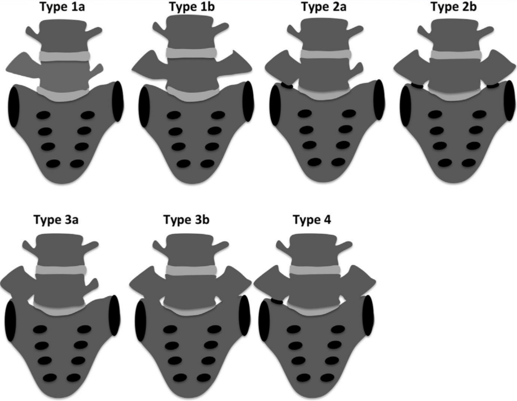 Zespol_Bertolottiego_-_klasyfikacja_Castellviego Zespół Bertolottiego
