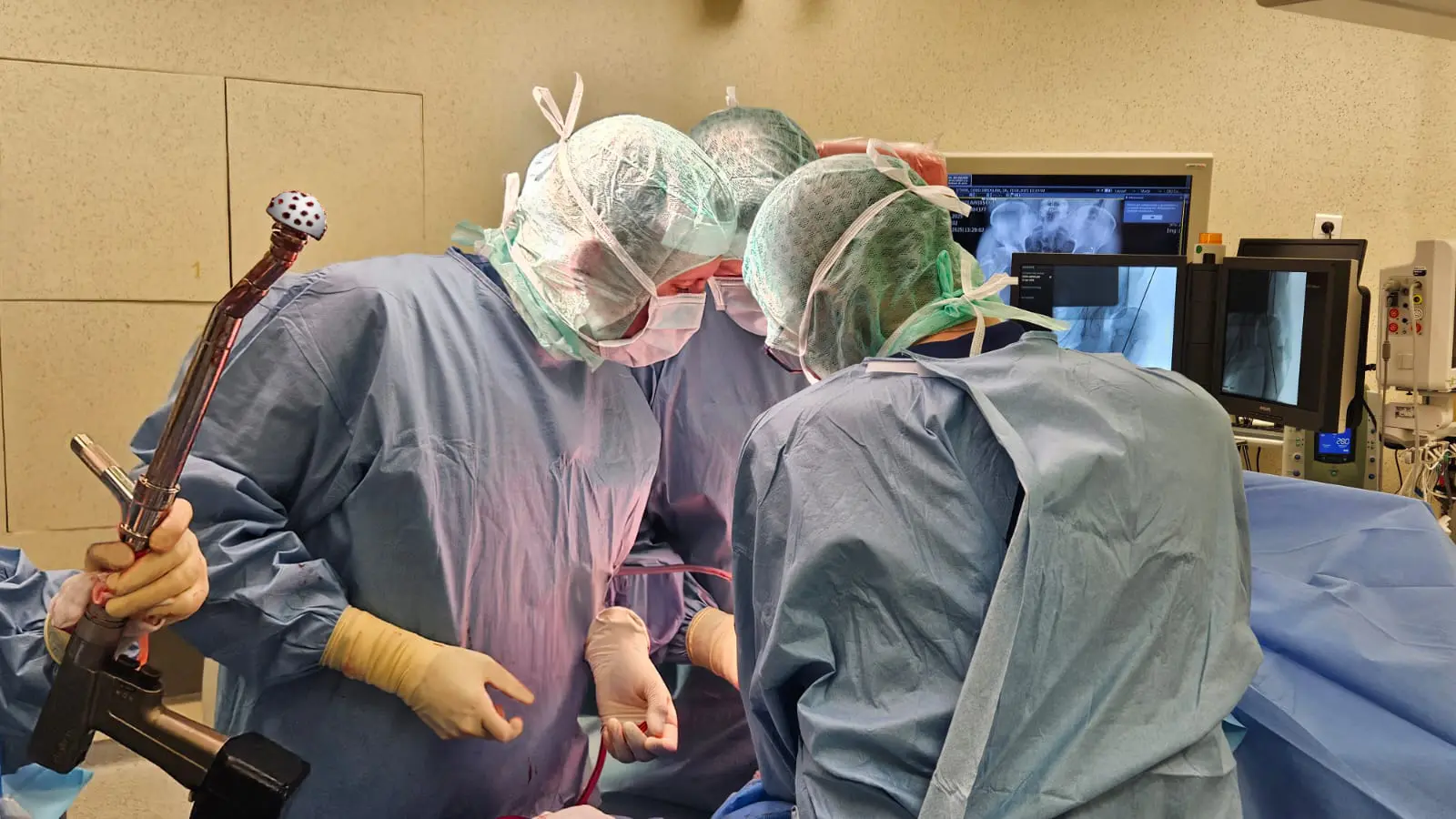 Kapoplastyka ceramiczna biodra