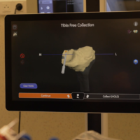 Operacje robotyczne kolana