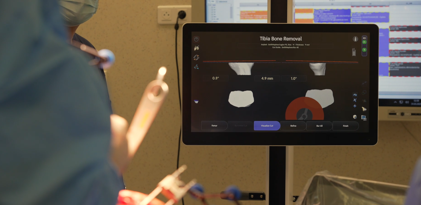 Dr Dudek i dr Wróbel wykonują operacje robotyczne kolana