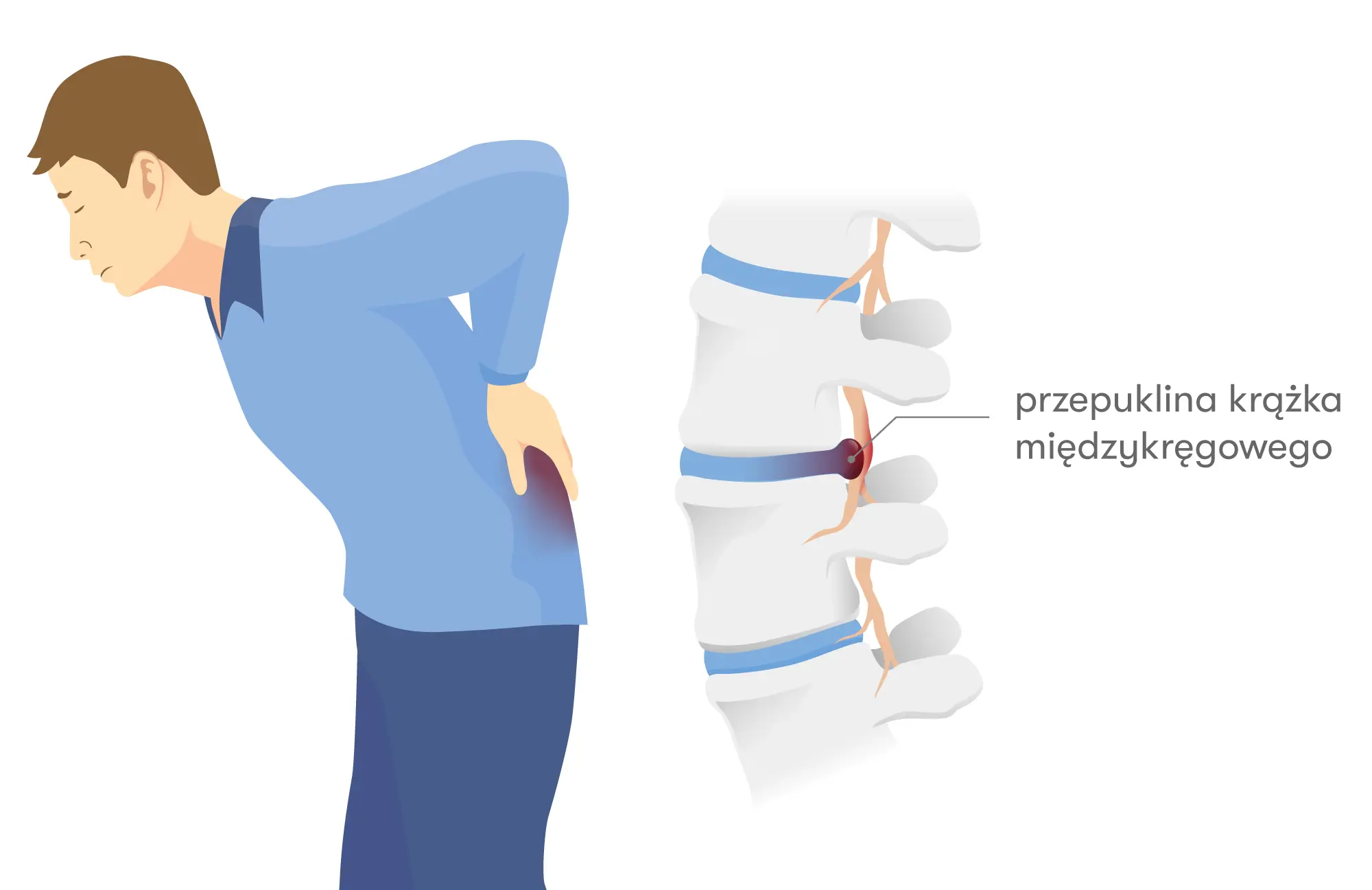 W Szpitalu Carolina wykonujemy endoskopowe operacje kręgosłupa