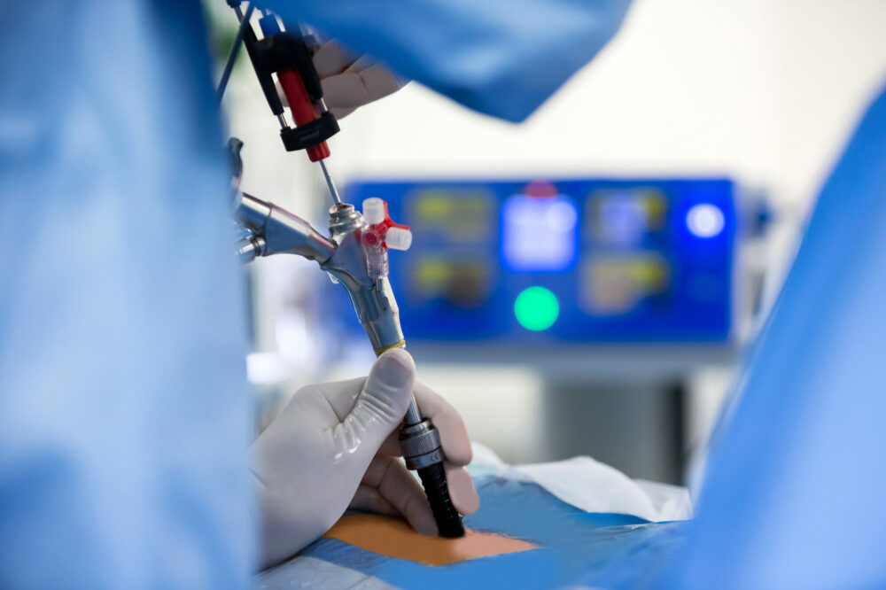 Endoskopowe-leczenie-dyskopati_informacja-prasowa_zdjęcie1_Carolina_Medical_Center