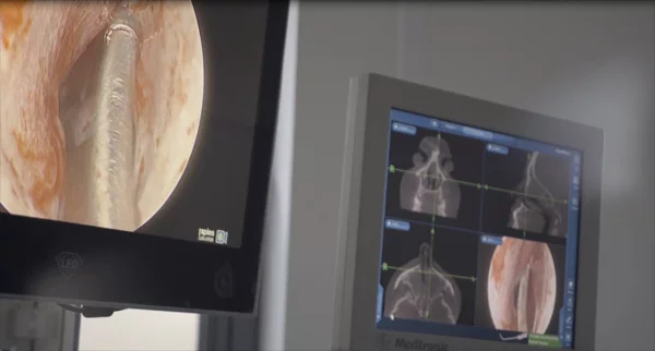 A56 Nawigacja pola operowanego – doskonalimy się dla Ciebie!