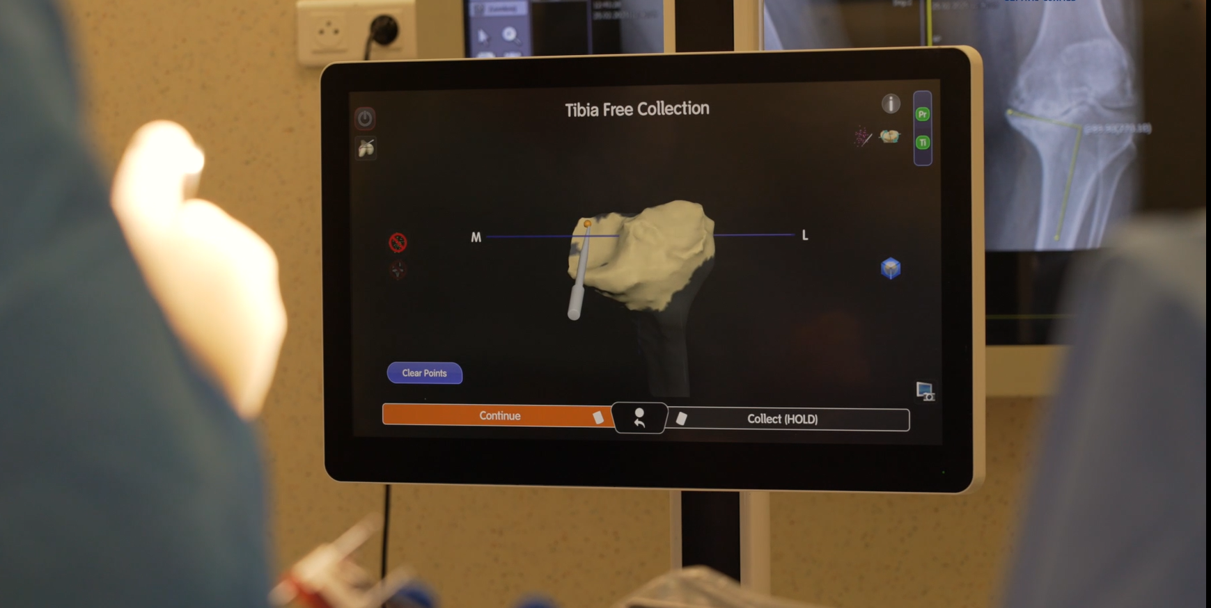 Robotic knee surgery